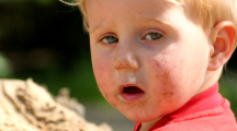 Enfant souffrant d'allergie